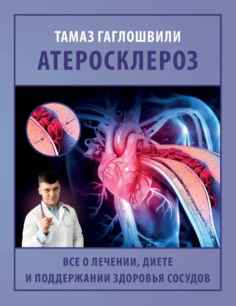 Обложка книги «Атеросклероз. Все о лечении, диете и поддержании здоровья сосудов»