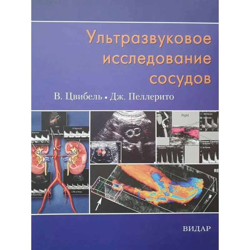 Обложка книги «Ультразвуковое исследование сосудов»