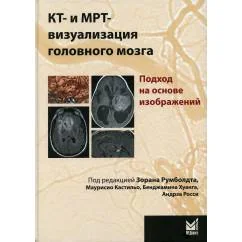Обложка книги «КТ- и МРТ- визуализация головного мозга : подход на основе изображений»