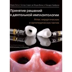 Обложка книги «Принятие решений в дентальной имплантологии. Атлас хирургических и ортопедических тактик»