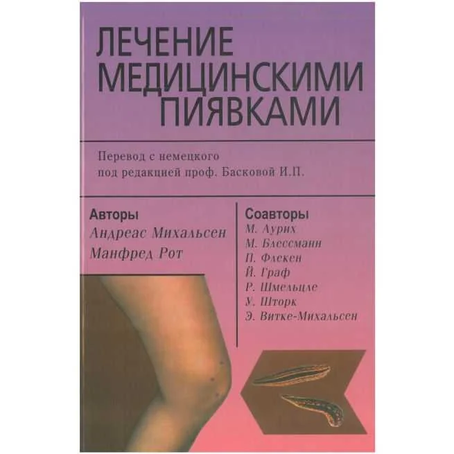 Обложка книги «Лечение медицинскими пиявками»